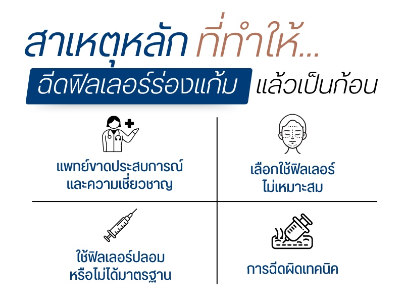 สาเหตุหลักที่ทำให้ฉีดฟิลเลอร์ร่องแก้มแล้วเป็นก้อน