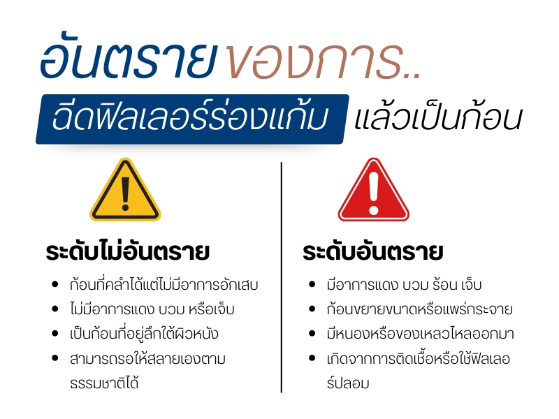 อันตรายของการฉีดฟิลเลอร์ร่องแก้มแล้วเป็นก้อน