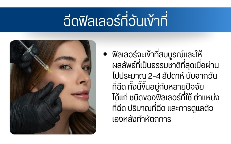 ฉีดฟิลเลอร์กี่วันเข้าที่