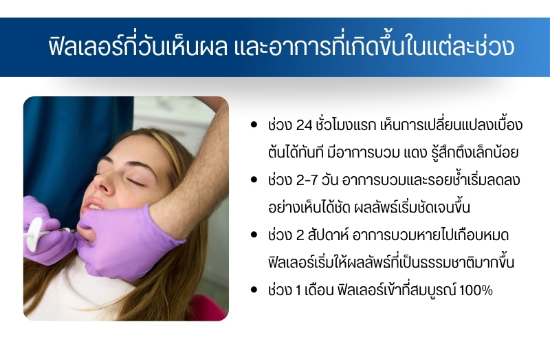 ฟิลเลอร์กี่วันเห็นผล และอาการที่เกิดขึ้นในแต่ละช่วง