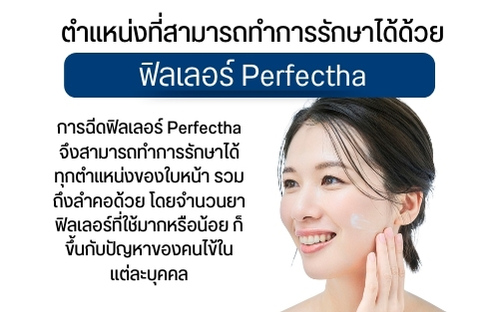 ตำแหน่งที่สามารถทำการรักษาได้ด้วย ฟิลเลอร์ Perfectha