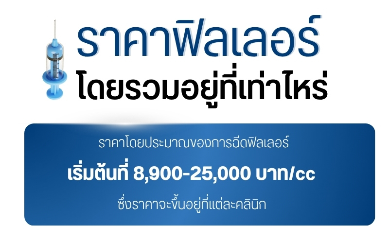 ราคาฟิลเลอร์โดยรวมอยู่ที่เท่าไหร่
