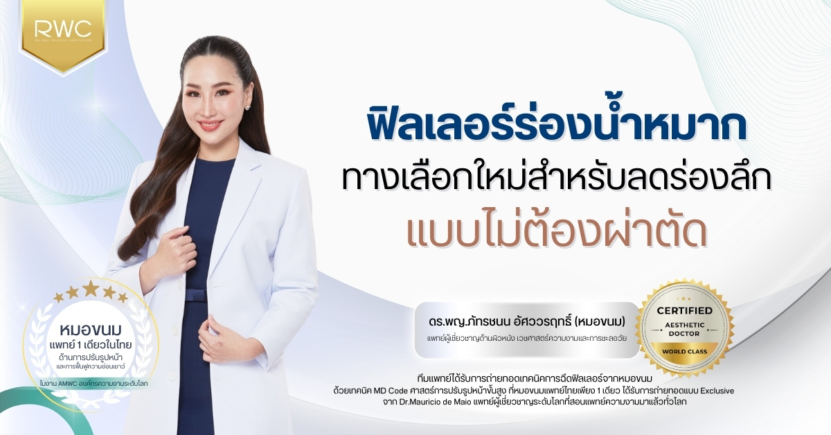ฟิลเลอร์ร่องน้ำหมาก ทางเลือกใหม่สำหรับลดร่องลึกแบบไม่ต้องผ่าตัด