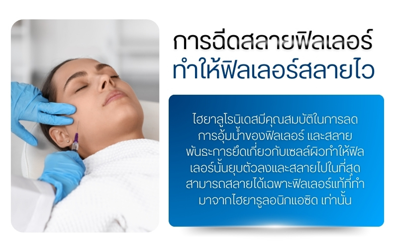 การฉีดสลายฟิลเลอร์ ทำให้ ฟิลเลอร์สลายไว