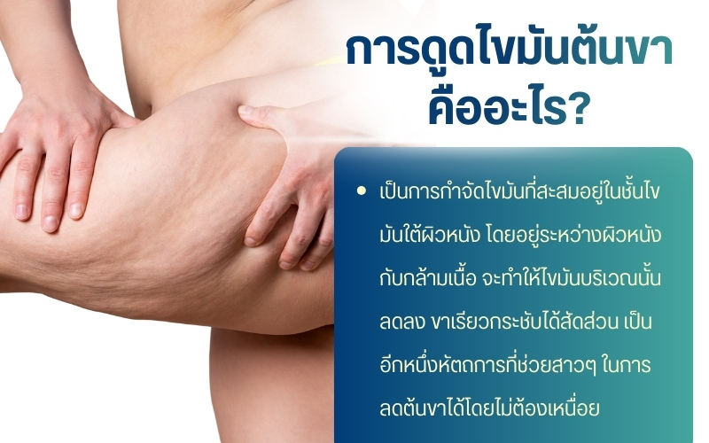 การดูดไขมันต้นขา คืออะไร