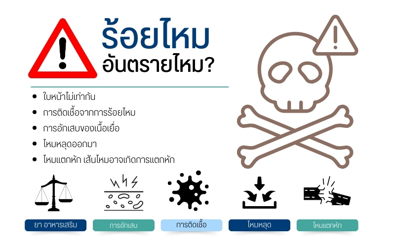 ร้อยไหม อันตรายไหม