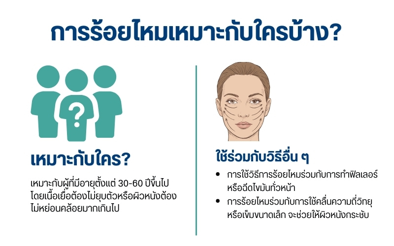 การร้อยไหมเหมาะกับใครบ้าง