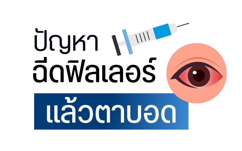 ปัญหาฉีดฟิลเลอร์แล้วตาบอด