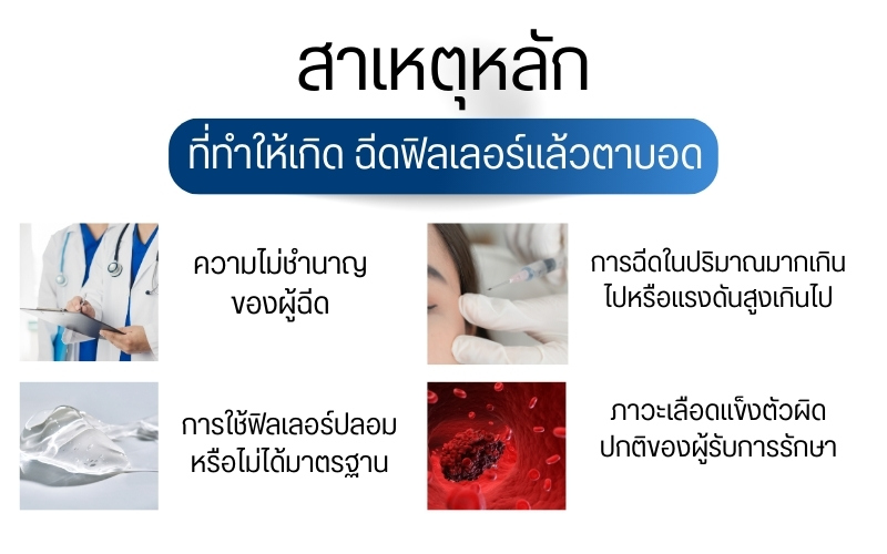 กลไกการเกิดและสาเหตุหลักที่ทำให้ฉีดฟิลเลอร์แล้วตาบอด