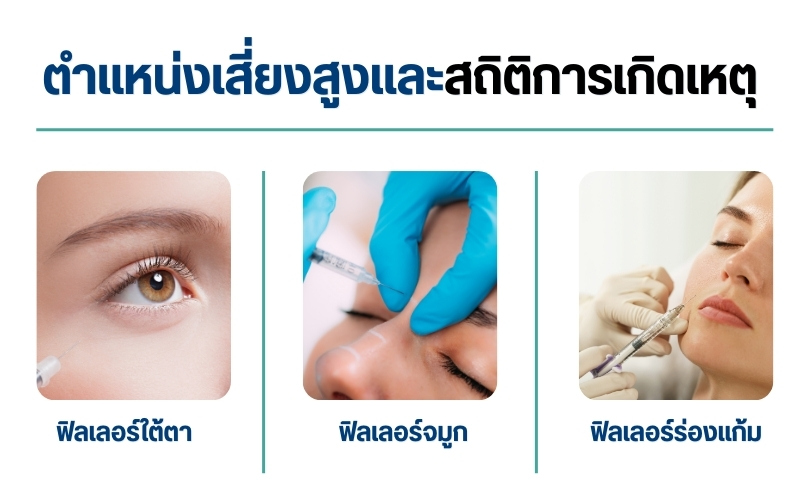 ตำแหน่งเสี่ยงสูงและสถิติการเกิดเหตุ