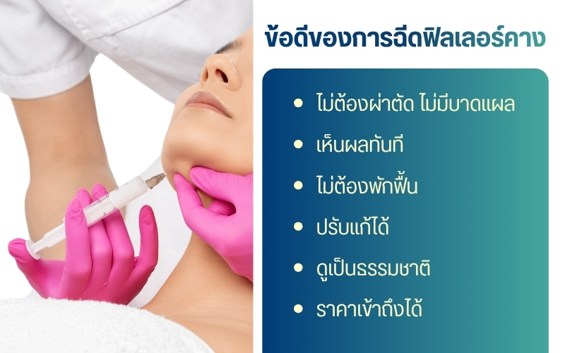 ข้อดีของการฉีดฟิลเลอร์คาง