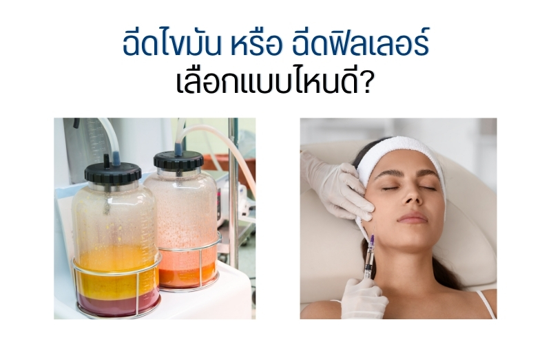 ฉีดไขมัน หรือ ฉีดฟิลเลอร์ เลือกแบบไหนดี?