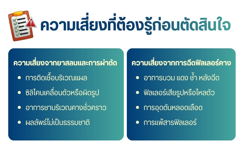 ความเสี่ยงที่ต้องรู้ก่อนตัดสินใจ