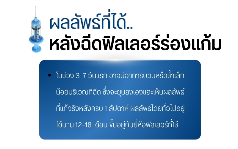 ผลลัพธ์ที่ได้หลังฉีดฟิลเลอร์ร่องแก้ม