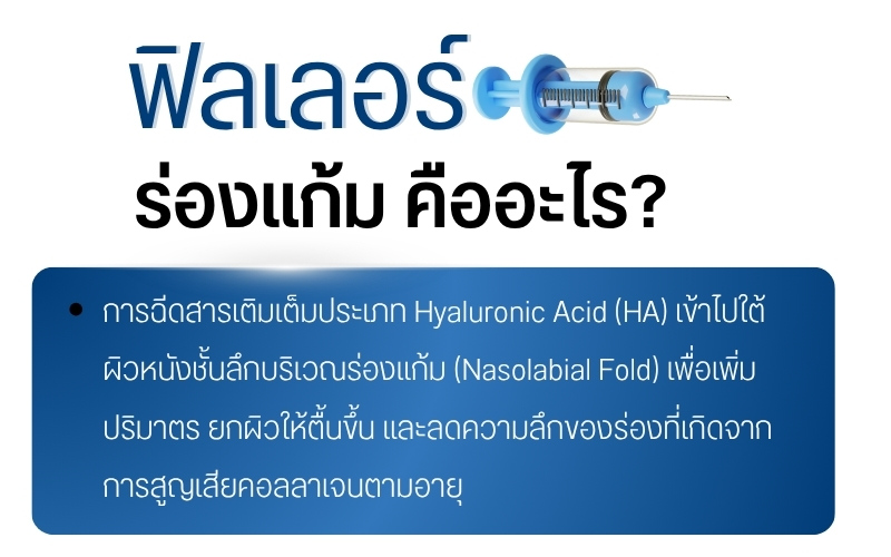 ฟิลเลอร์ร่องแก้ม คืออะไร