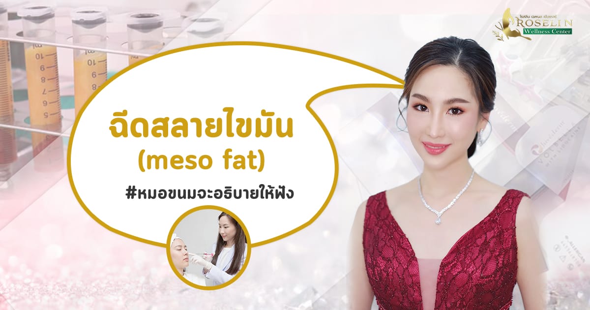 ฉีดเมโสแฟต