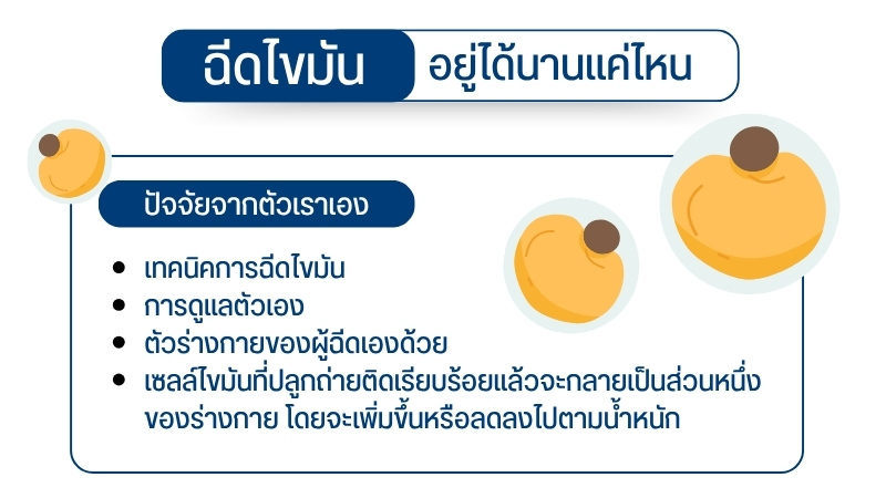 ฉีดไขมันอยู่ได้นานแค่ไหน