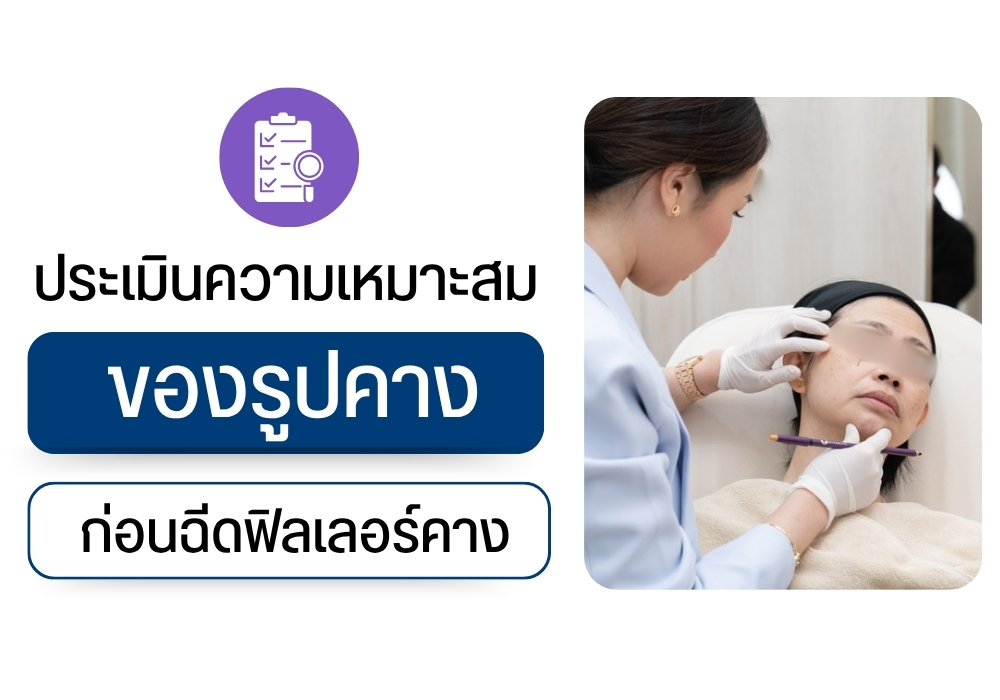  ประเมินความเหมาะสมของรูปคางก่อนฉีดฟิลเลอร์คาง