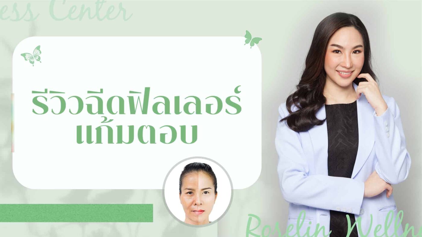 รีวิวฉีดฟิลเลอร์แก้มตอบ