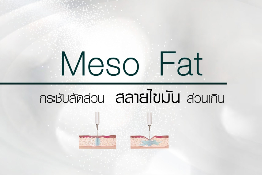 Meso Fat ต้นขา ราคา