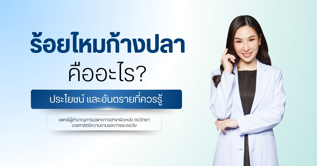 ร้อยไหมก้างปลา คืออะไร