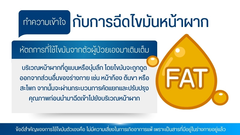 ทำความเข้าใจกับการฉีดไขมันหน้าผาก
