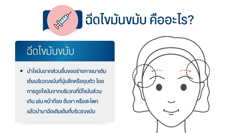 ฉีดไขมันขมับ คืออะไร