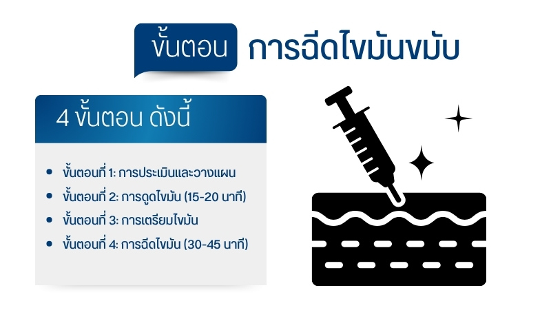 ขั้นตอนการฉีดไขมันขมับ