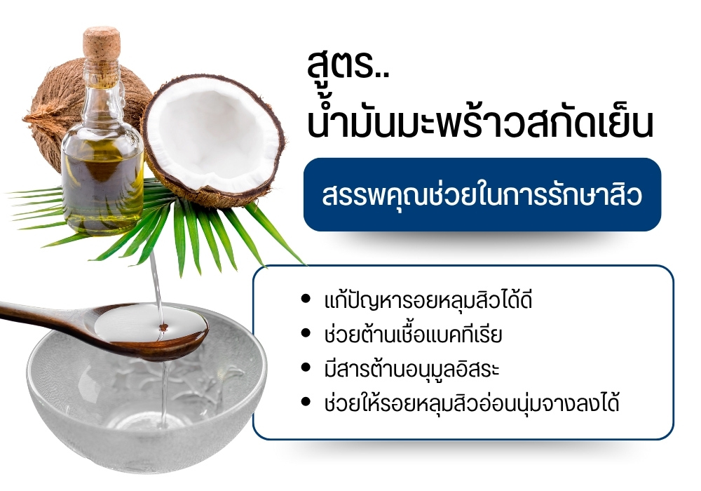 สูตรน้ำมันมะพร้าวสกัดเย็นรักษาหลุมสิว