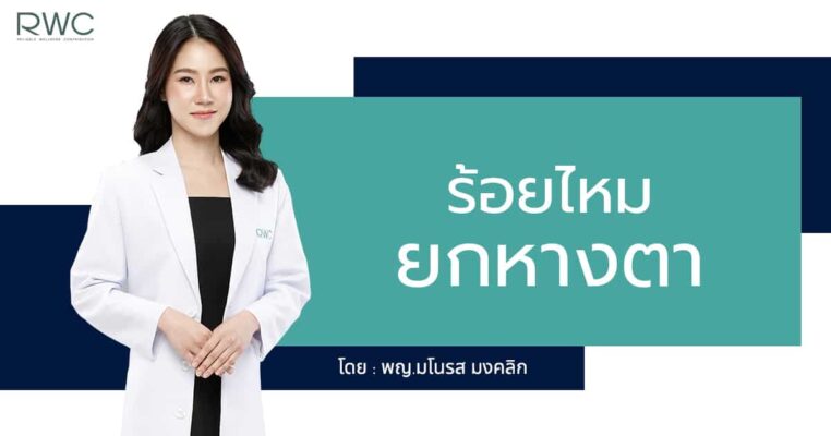 ร้อยไหม ยกหางตา