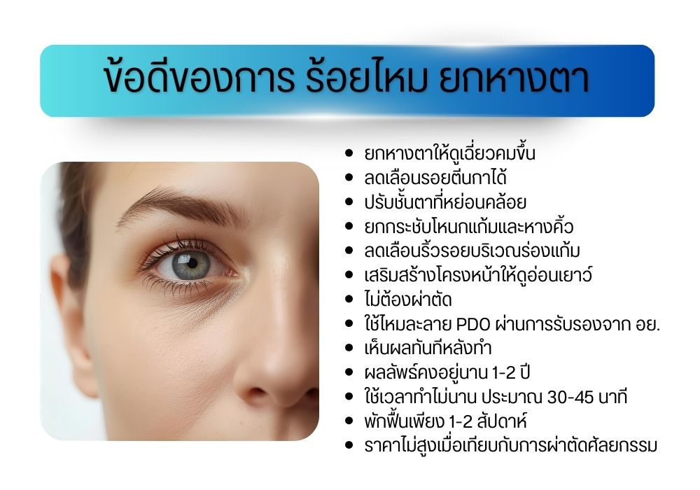 ข้อดีของการ ร้อยไหม ยกหางตา