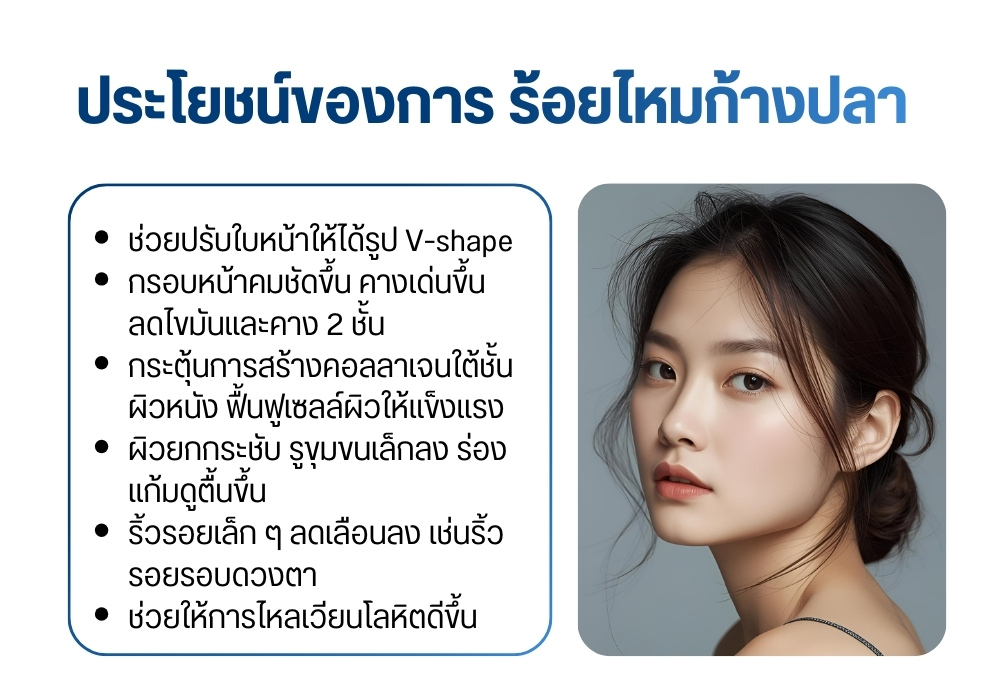 ประโยชน์ของการ ร้อยไหมก้างปลา