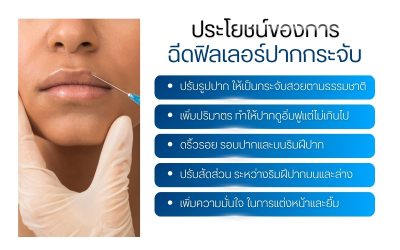 ประโยชน์ของการฉีดฟิลเลอร์ปากกระจับ