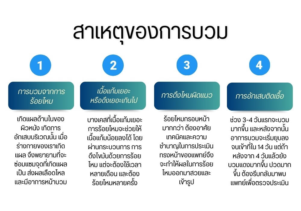 สาเหตุของการบวม