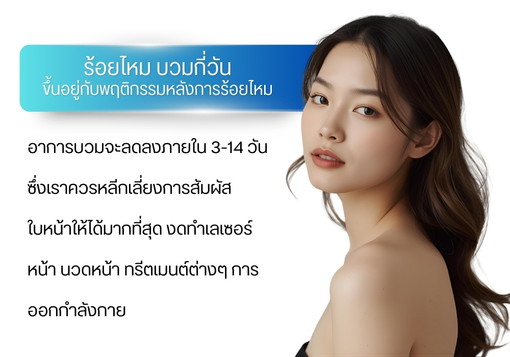 ร้อยไหม บวมกี่วัน ขึ้นอยู่กับพฤติกรรมหลังการร้อยไหม
