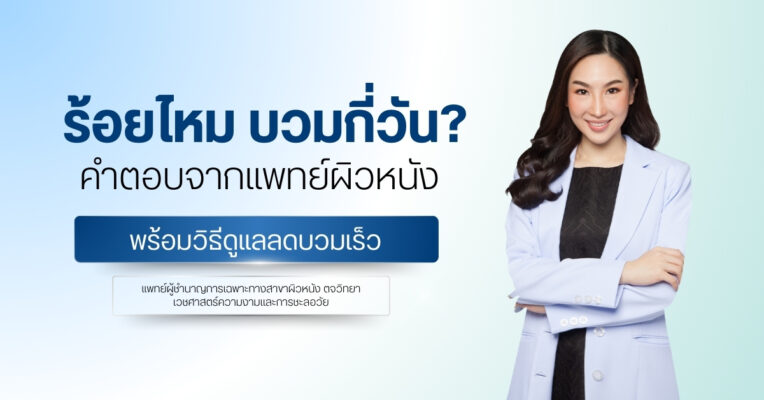 ร้อยไหม บวมกี่วัน