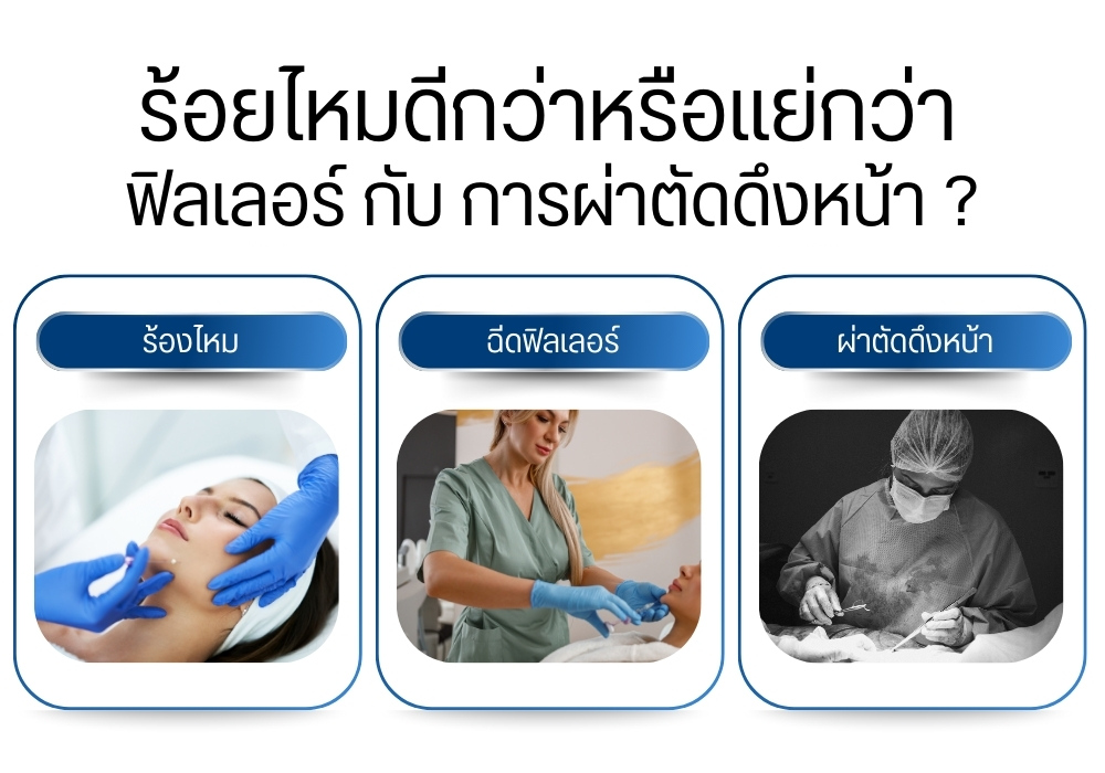 ร้อยไหมดีกว่าหรือแย่กว่า ฟิลเลอร์ กับ การผ่าตัดดึงหน้า ?