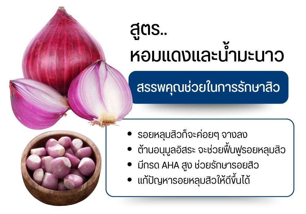 สูตรหอมแดงและน้ำมะนาวรักษาหลุมสิว