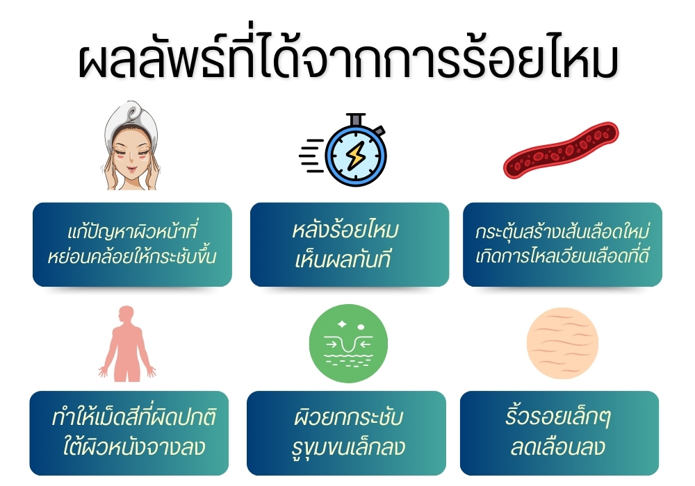 ผลลัพธ์ที่ได้จากการร้อยไหม