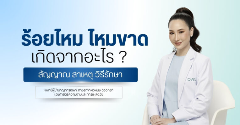 ร้อยไหม ไหมขาด เกิดจากอะไร ? สัญญาณ สาเหตุ วิธีรักษา