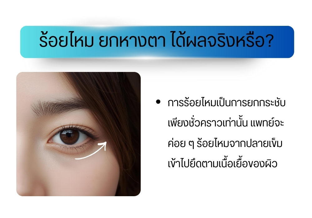 ร้อยไหม ยกหางตา ได้ผลจริงหรือ