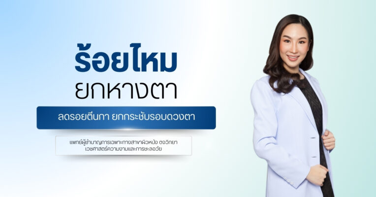 ร้อยไหม ยกหางตา