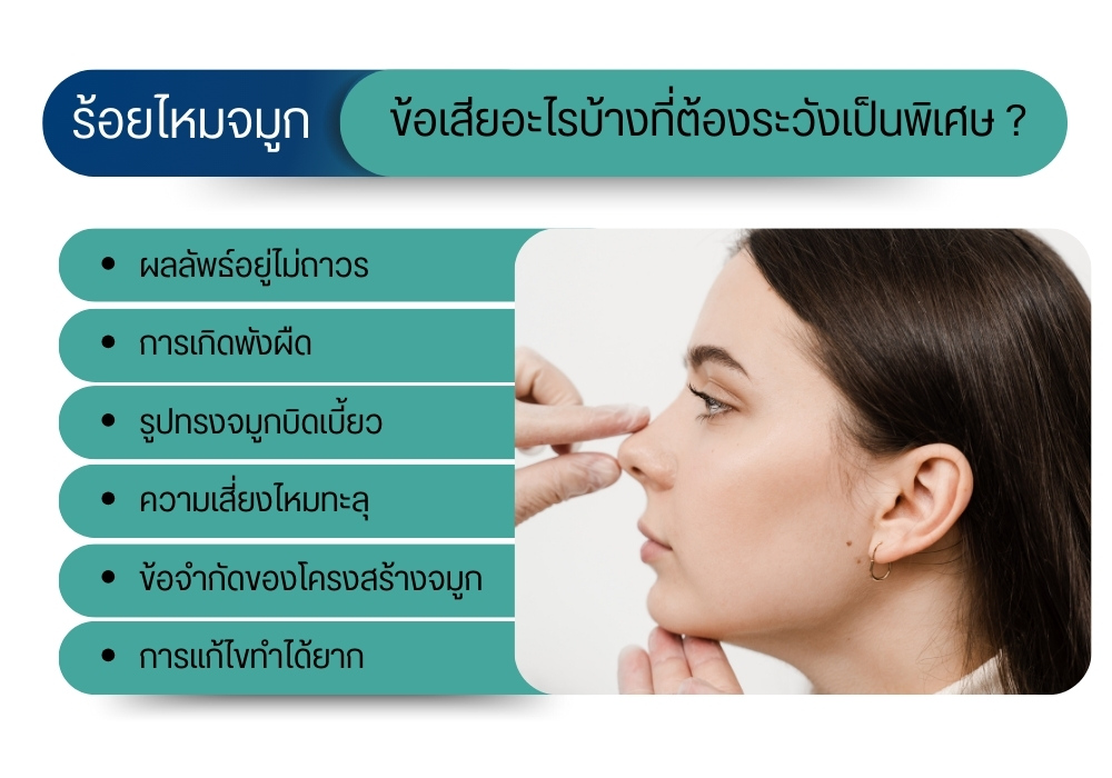 ร้อยไหมจมูก ข้อเสียอะไรบ้างที่ต้องระวังเป็นพิเศษ ?