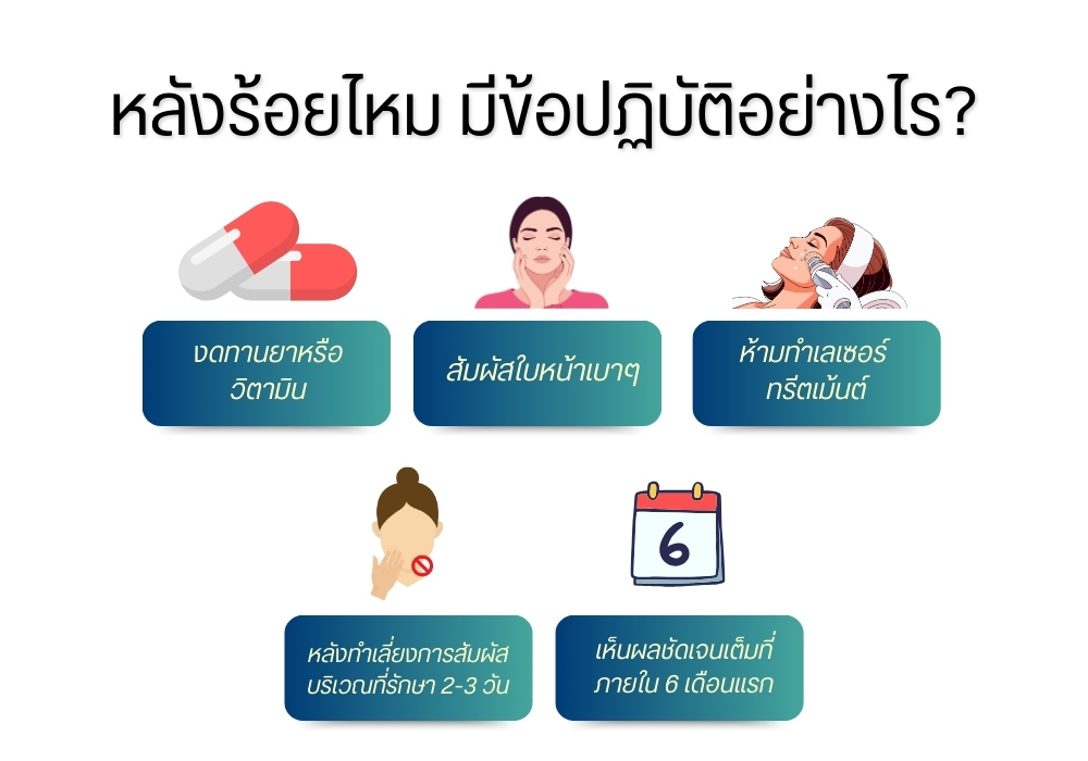 หลังร้อยไหม มีข้อปฏิบัติอย่างไร