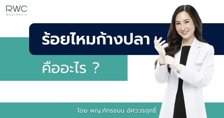 ร้อยไหมก้างปลา ที่ไหนดี