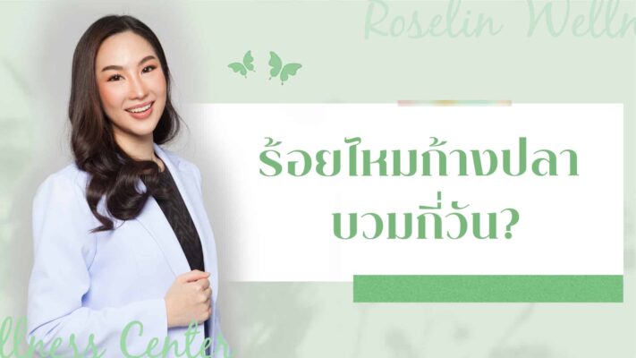 ร้อยไหมก้างปลา บวมกี่วัน