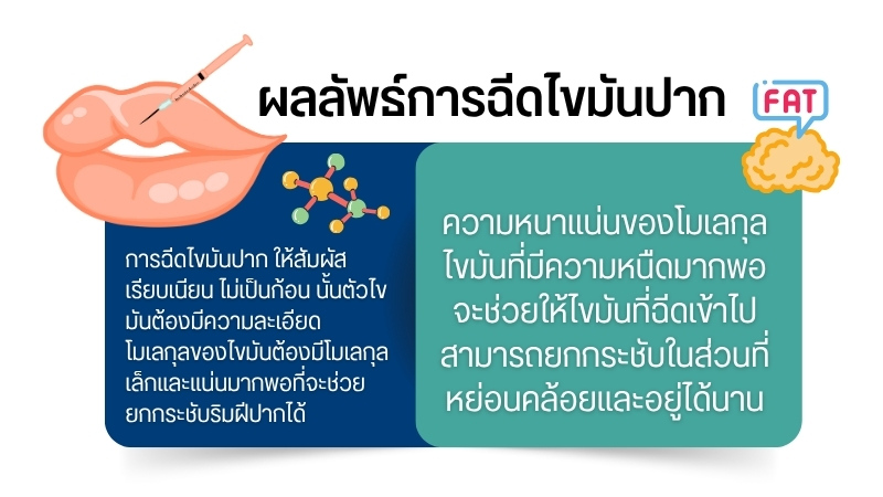 ผลลัพธ์การฉีดไขมันปาก