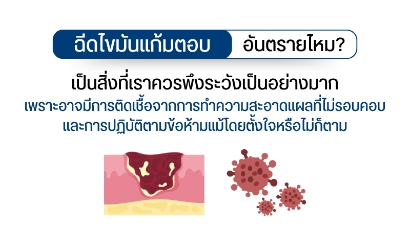 ฉีดไขมันแก้มตอบ อันตรายไหม