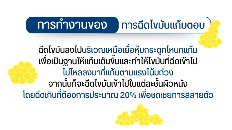 การทำงานของการ ฉีดไขมันแก้มตอบ