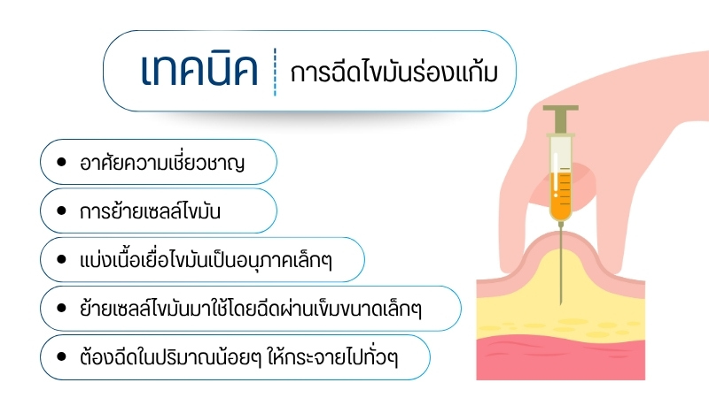 เทคนิคการฉีดไขมันร่องแก้ม